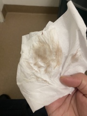 Implantation bleeding? 