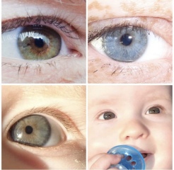 Eye colour