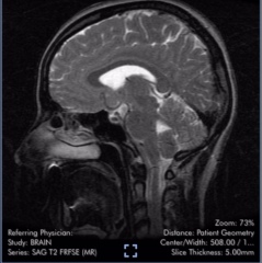 Brain scan - what is this??