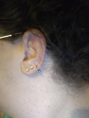 Ear piercing advice for hearing aid wearer. 