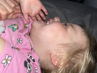 Could this be chickenpox!???