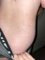 Does anyone have any idea what this rash could be?