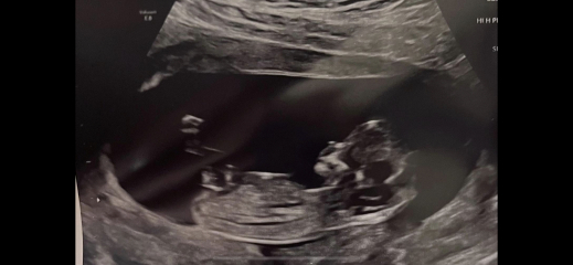 Due January 2024 🎉 PART 3