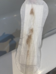 Has anyone experienced this? (Picture included)