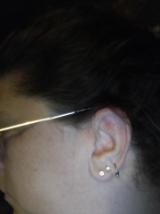 Ear piercing advice for hearing aid wearer. 