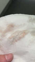 Implantation bleeding 