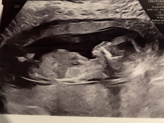 Scan help please