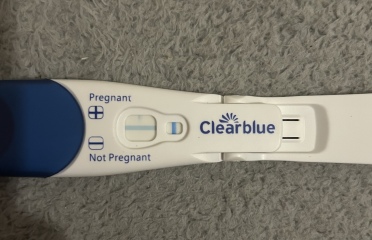 Strange line on CB?