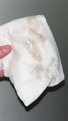 Implantation bleeding? 