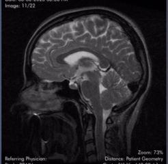 Brain scan - what is this??