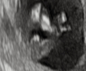 Boy or Girl?