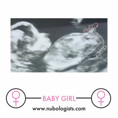 13 weeks pregnant and gender confusion