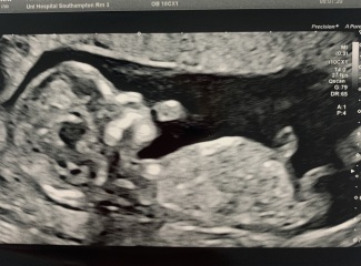Gender guess please 