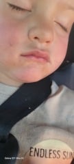 Anyone know what this might be called? Small red mark on toddlers lip?