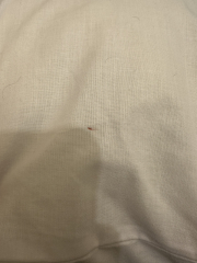 What do I do?! BEDBUGS