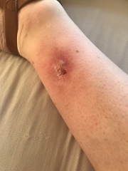 Doctor tonight? Infection or allergy?