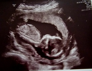 Is she 100% a girl 🙈 16 weeks