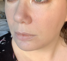 3 years of skin and me