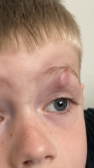 To go to A&E