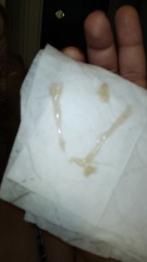 (GRAPHIC PICTURE) Is this fertile Mucus? Or Mucus Plug. sorry tmi !!!