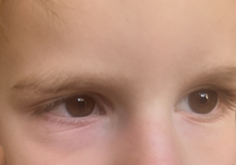 Is this hay fever?