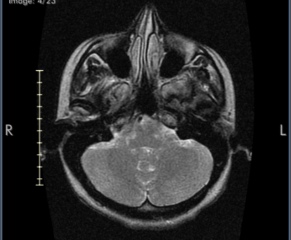 Brain scan - what is this??