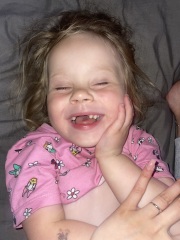 Could this be chickenpox!???