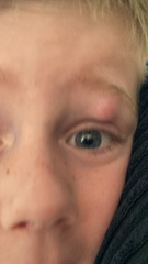 To go to A&E
