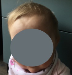 Worried about 7 months old forehead shape, pics included.