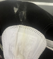 Is this discharge normal? TW picture included