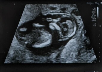 Gender guesses (scan photos included!)