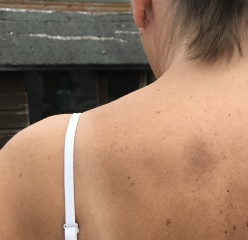 Weird dodgy patch on skin?