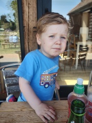 ? Rash, surely not chicken pox?