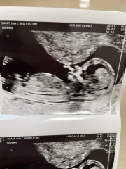 Nub theory - 13 weeks and 1 day