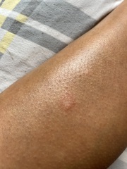 Weird patches on legs (pics)