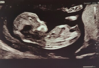 Due January 2024 🎉 PART 3