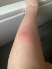 Does this look ok (bite related)