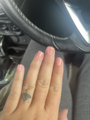 Melanoma scare advice please