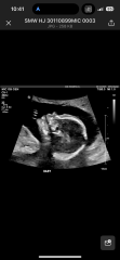 November 2023 babies - thread 4