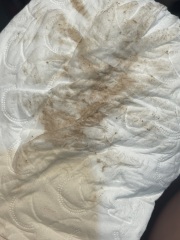 Has anyone experienced this? (Picture included)