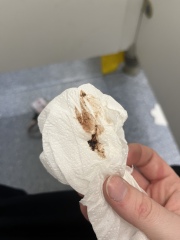 Brown clot and blood at 11+4 