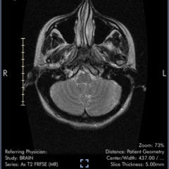 Brain scan - what is this??