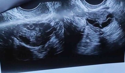 Ultrasound Help
