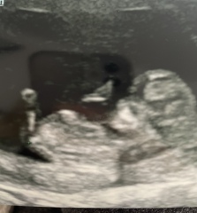 Thoughts…. Boy or girl?