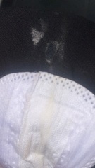 Is this discharge normal? TW picture included