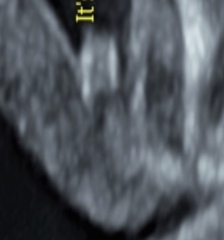 Gender prediction help!! Think my scan has been read wrong! Let me know thoughts!