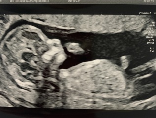 Gender guess please 