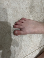 Is there something wrong with my daughter’s toes?