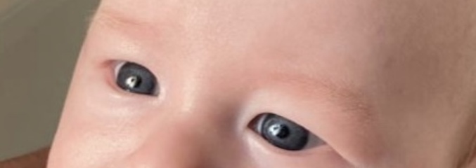Will my babies eyes go brown?