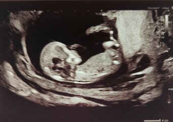 Due January 2024 🎉 PART 3